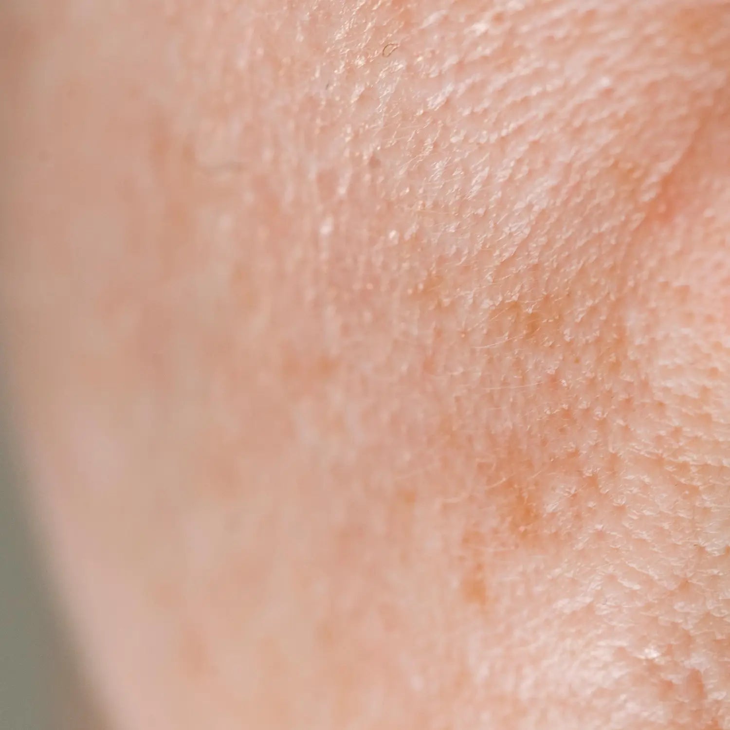 Close-up of human skin texture APEXEL microscope lens