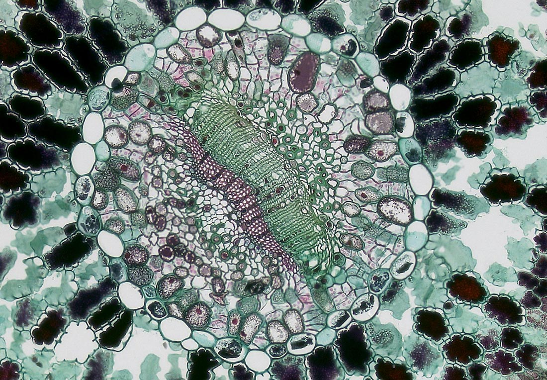 Microscope blood samples with Apexel PhoneMicro 5 200X mobile phone