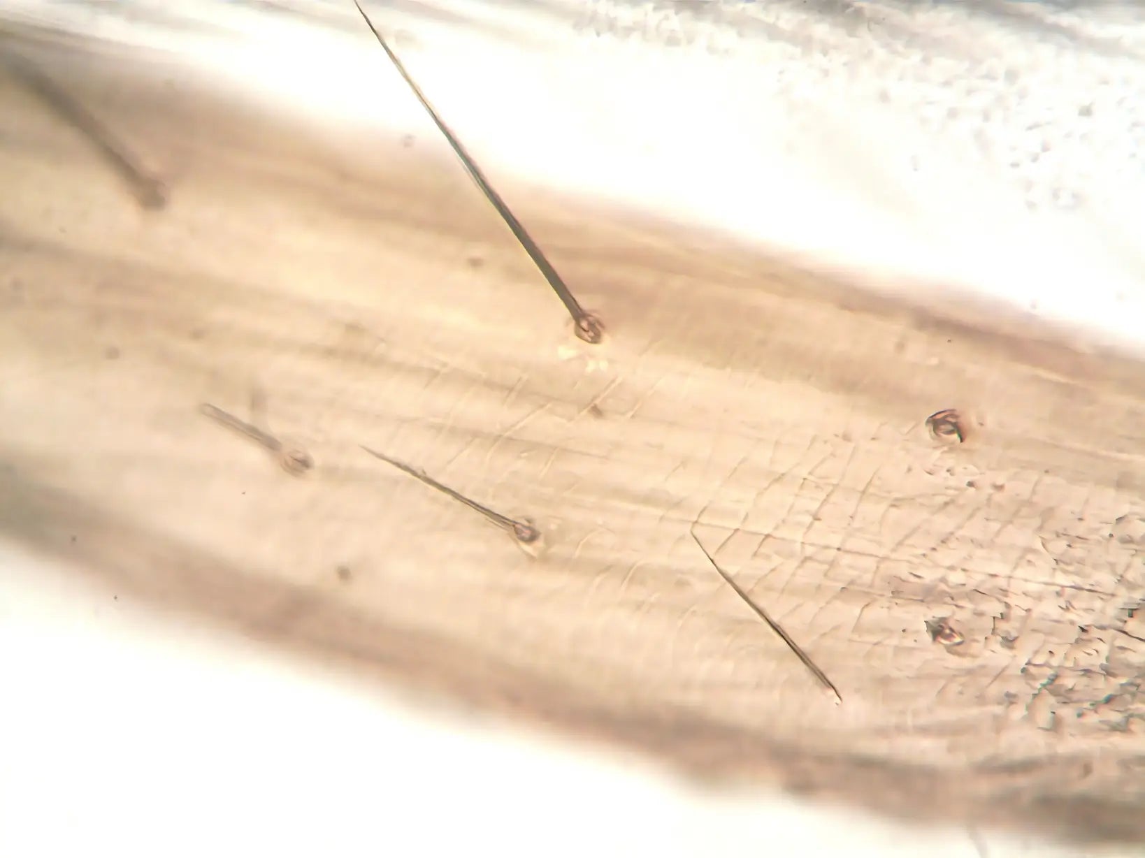 Skin & hair structure captured by a 300x mobile phone microscope lens APEXEL